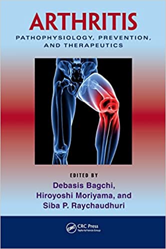 Arthritis: Pathophysiology, Prevention, and Therapeutics